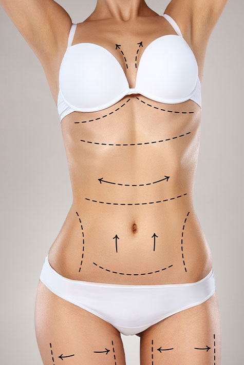 Lipotransfer